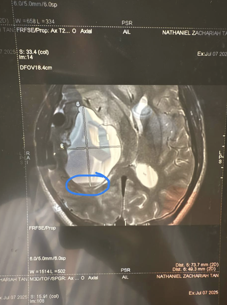 nathaniel tan mri scan